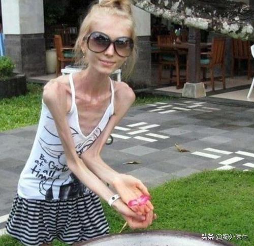 体重下降百分比计算公式(疯狂减肥危害大！人的标准体重是多少？医生教你计算方法)