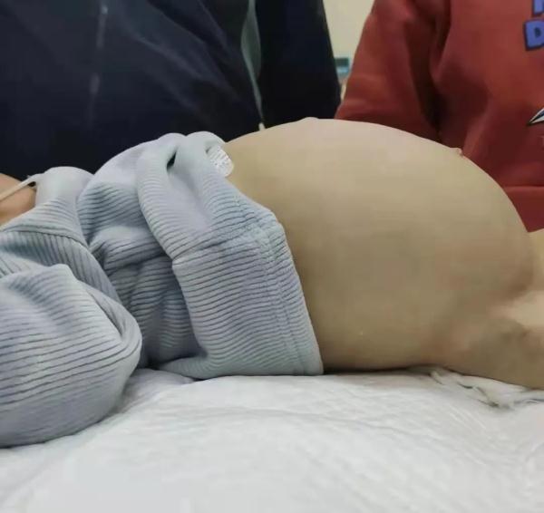 宝贝还要吗大不大舒服吗(误吞这种玩具三个月，1岁男童腹胀如鼓)