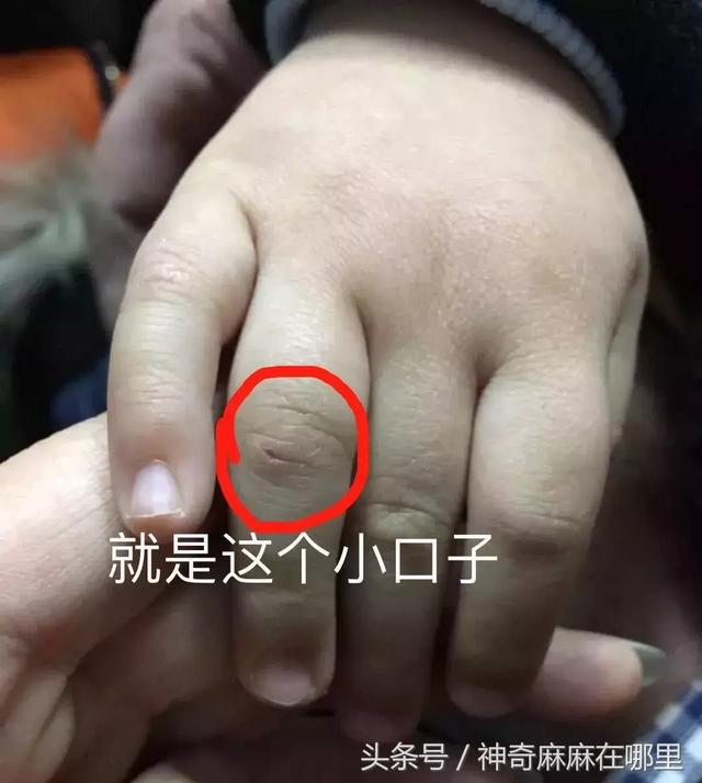 gpm医学上是什么意思(土根在意大利有一个终身制的疫苗医生，我刚去时特别意外……)