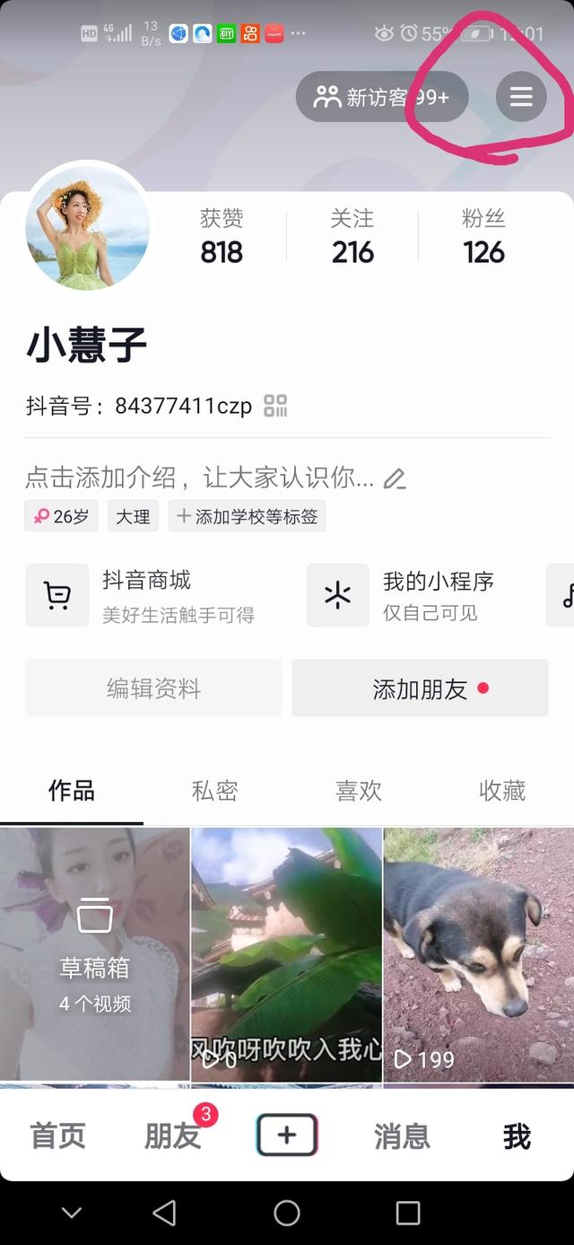 抖音怎么设置动态壁纸权限(抖音账号如何设置隐私，想了解吗？)