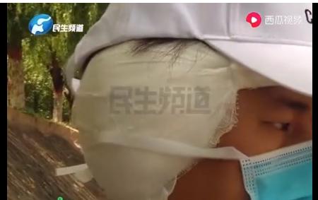 苹果爆炸事件真的吗(AirPods发生多起爆炸事故，有人当场被炸晕！苹果正采集设备进一步调查)