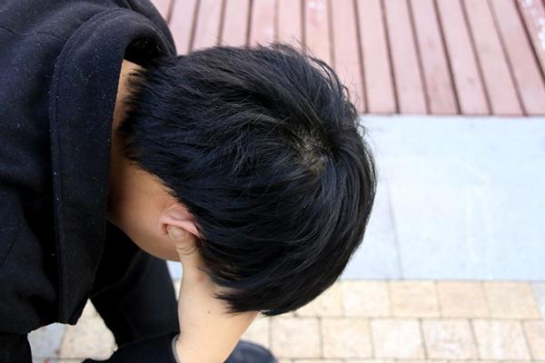 米诺地尔(2.5亿人快秃了，用米诺地尔能生发、防脱？是真的，但没这么简单)