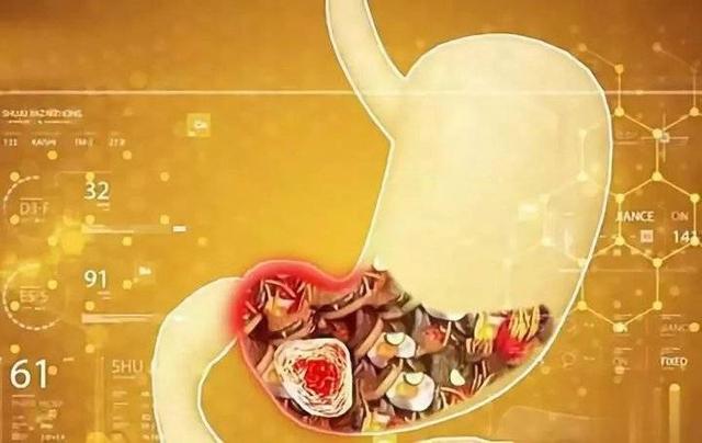 胃病不宜吃10种食物:胃不好的人，6种食物医生劝你少吃！这些才是真正的养胃法