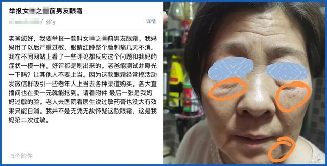 辨别屏蔽和删光朋友圈2021(这些错误的护肤方法，真的很毁脸，别再用了)