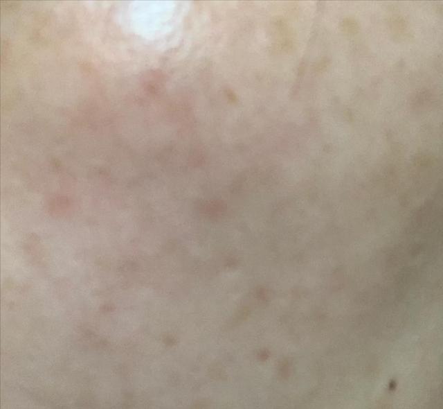 欧诗漫祛斑效果好不好(美白面膜欧诗漫反馈)