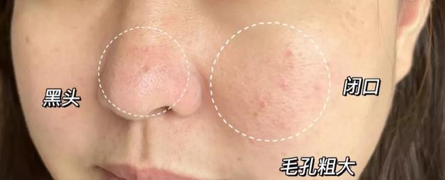 妍诗美的护肤品好不好用(值得买！|“真香”洁面，用完一把爱住)